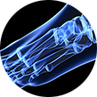 At Orthopedic Associates, we specialize in treatment of the foot